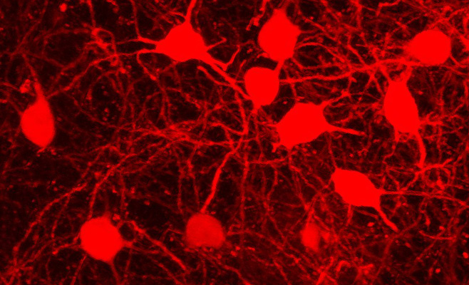Neuronas de proyección estriatal